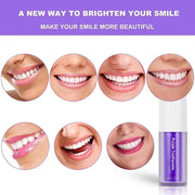 Teeth Brightening